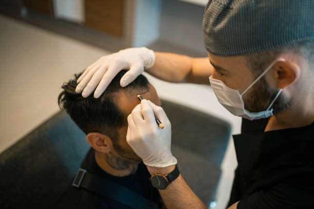 Hair Transplant in Riyadh