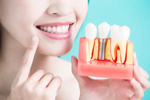 Tooth Implant in Cudahy