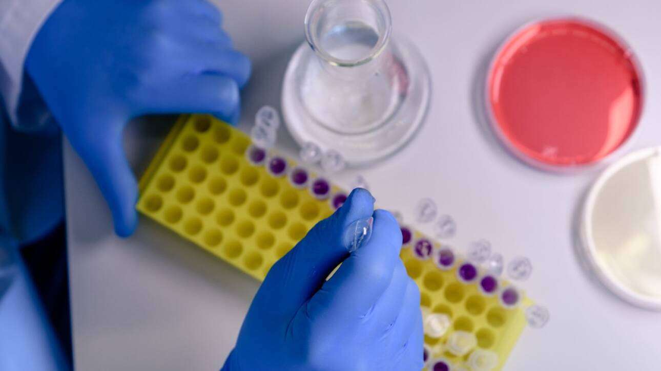 Magnetic Beads Protein Purification