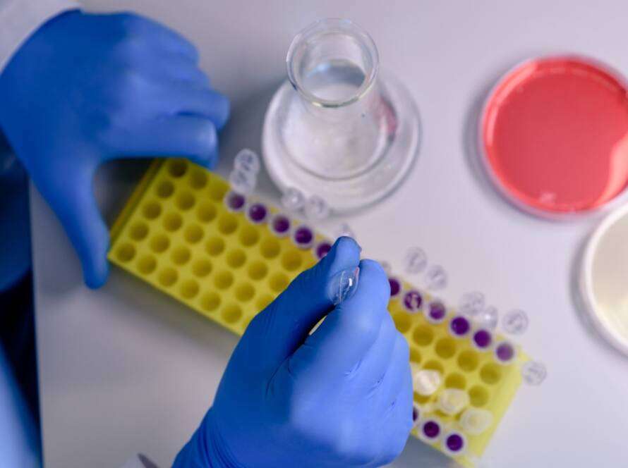 Magnetic Beads Protein Purification