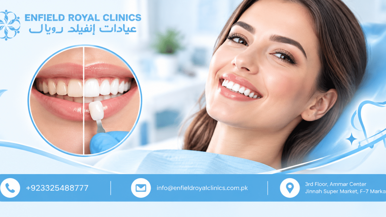 Laser Teeth Whitening in Islamabad