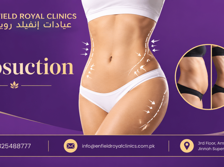 Liposuction In Islamabad