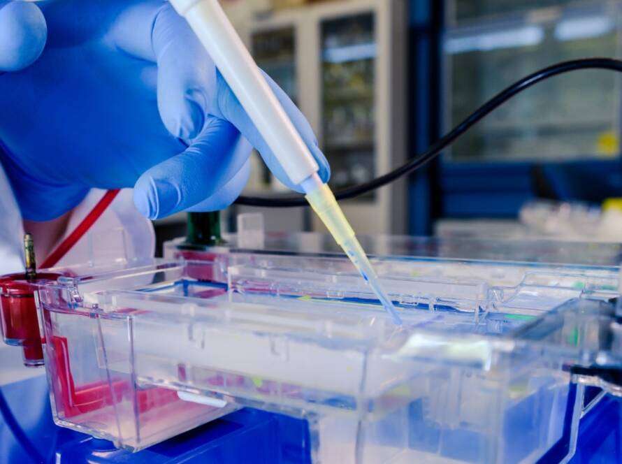 SDS PAGE Electrophoresis