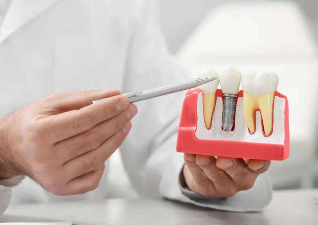 dental implants in dubai