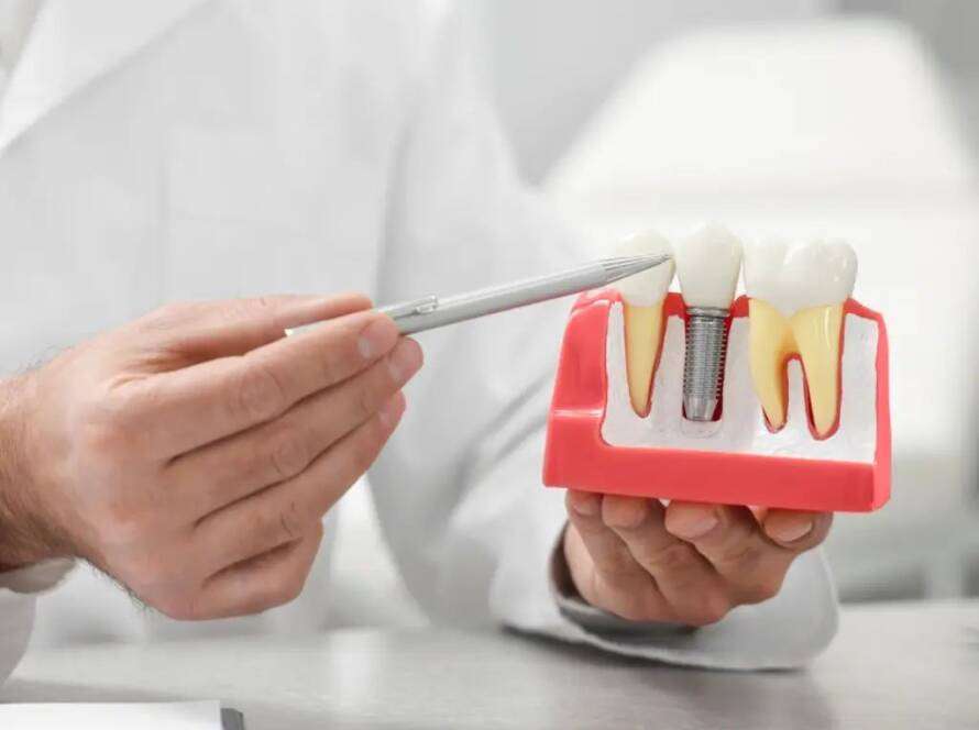 dental implants in dubai