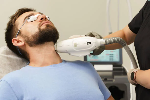 Is Beard Laser Hair Removal Good for Thick Hair