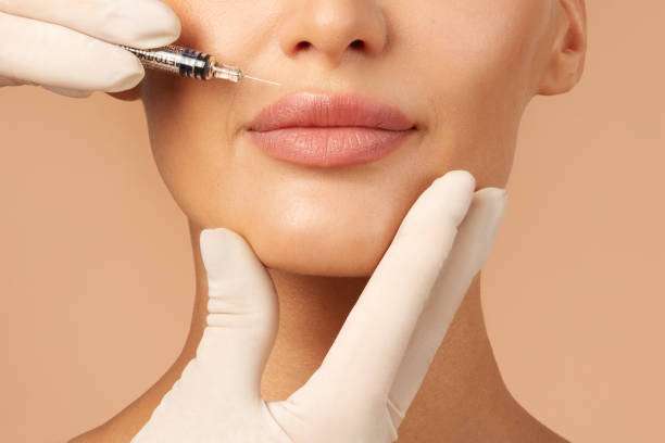 Is Lip Fillers Suitable for Different Lip Shapes
