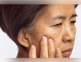 Natural Remedies for Common Skin Concerns featuring gentle skincare ingredients for healthy-looking skin