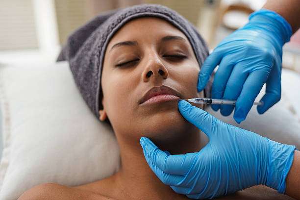 What Are the Main Benefits of Lip Fillers Treatment