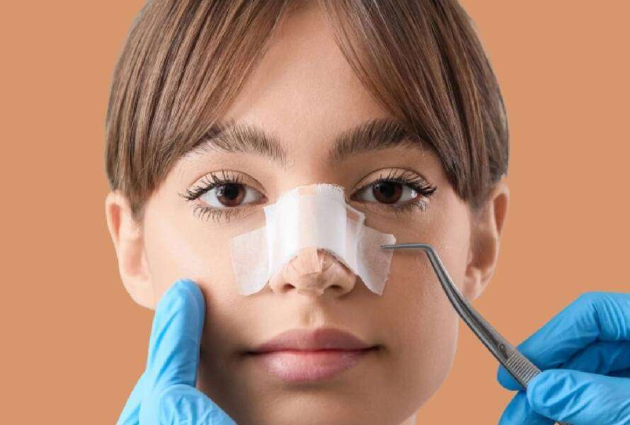 rhinoplasty in dubai